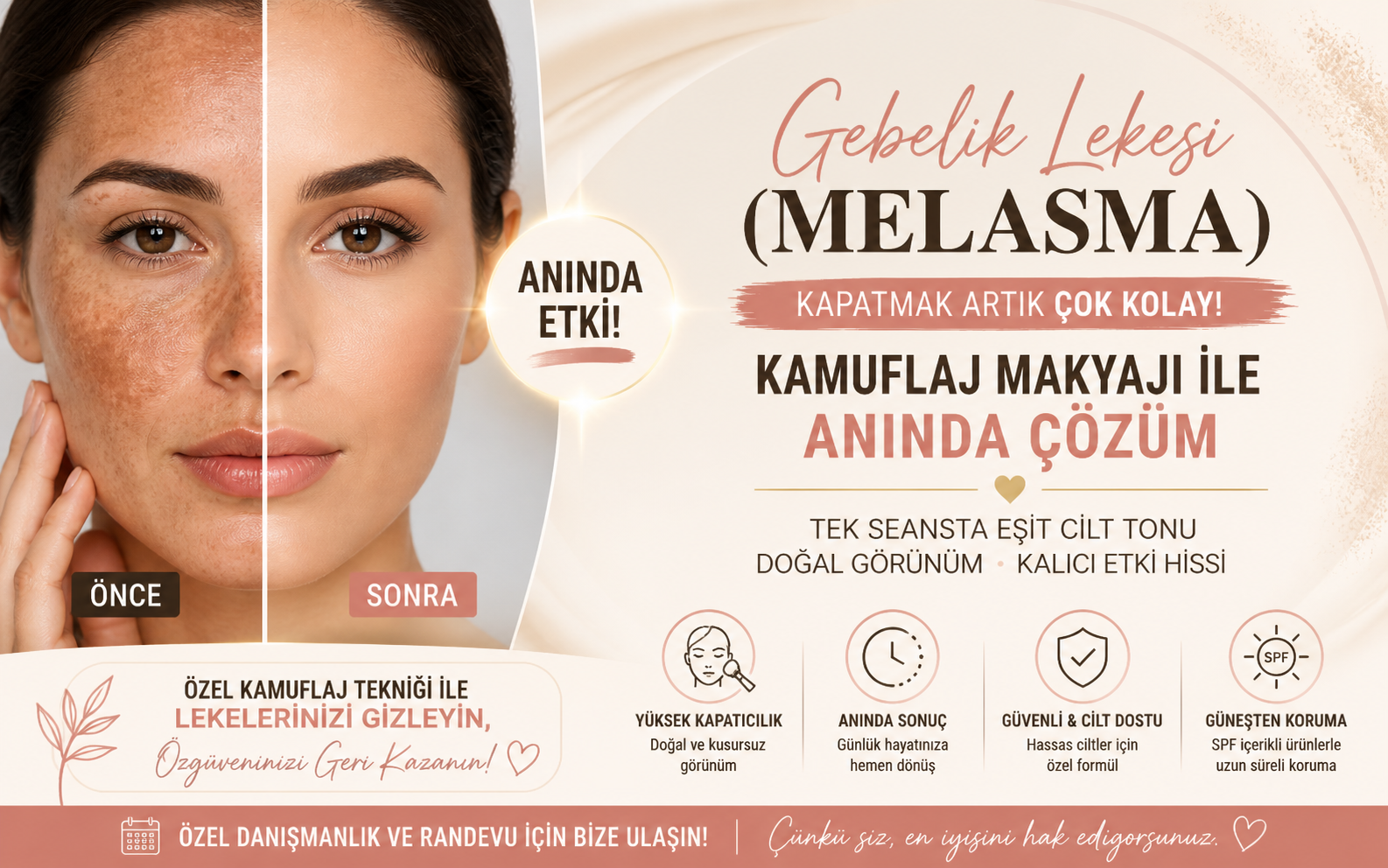 Gebelik Lekesi (Melasma) Kapatma: Kamuflaj Makyajı ile Anında Çözüm